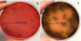 Listeria monocytogenes infection in pregnant women and newborns is a cause for serious concern this trend continues with a recent report of listeria chromogenic agar applied to the diagnosis of. Selectivity And Differentiation In One Place Solus Listeria Oa Agar Plates