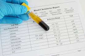 The normal range of values for alt (sgpt) is about 7 to 56 units per liter of serum. Urobilinogen In Urine Low High Levels Normal Range Selfhacked