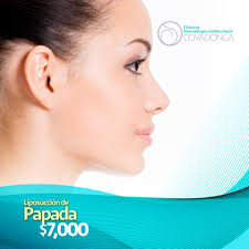 La liposucción de la papada o...