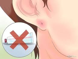 Take Care Of Pierced Ears Ear Piercing Care Infected Ear Piercing Kids Ear Piercing