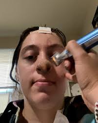 She has to shave her nose twice a week!😲