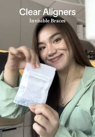 Fitting Clear Aligners: A Step-by-Step Guide