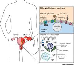 Image result for Chlamydia Trachomatis