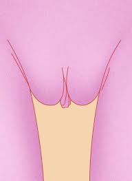 They most commonly occur on the inner surface of the lower lip (75% of cases) but may also appear on the. 9 Vagina Types Why There S No Such Thing As Normal Labia