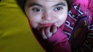 Disabled NJ Girl Denied Transplant Gets Mother's Kidney