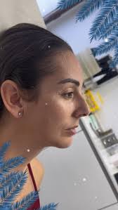 🎄✨ Día de Rodolfo el Reno: ¡Celebra tu nariz y gana un precio especial en  Elevación de Punta Nasal! ✨🎄, Hoy en nuestro Calendario de Adviento  Esquivel, celebramos al reno más famoso de la Navidad: ...