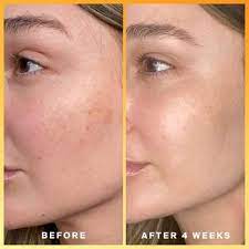 However, you can also use it at night if you prefer. Daily Dose Vitamin C Spf 40 Sunscreen Serum Pa Supergoop Sephora