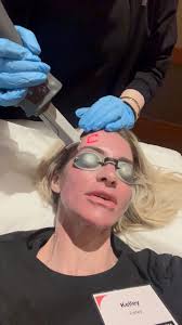 Have you heard of the Helix? The HELIX laser treatment can be worth it for  many clients seeking skin rejuvenation, as it addresses skin concerns like  wrinkles, acne scars, and sun damage with minimal ...