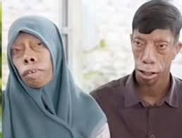 Esta es la familia con el 'rostro m&aacute;s raro del mundo', una malformaci&oacute;n  gen&eacute;tica hace que sus rasgos cambien