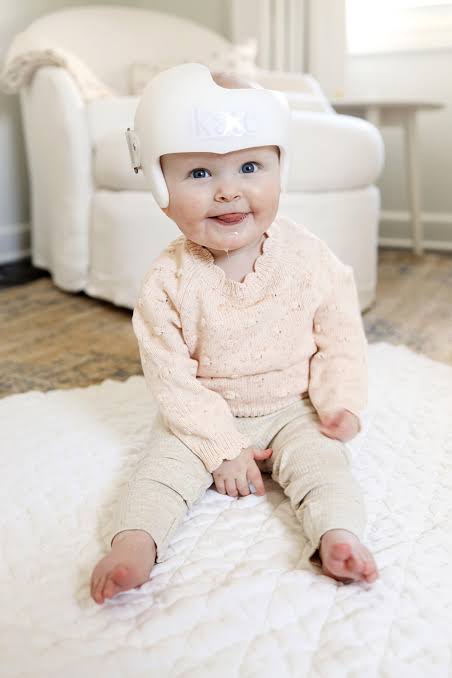 Our Experience with a Baby Helmet -فالخوذة العلاجية PioHelmet