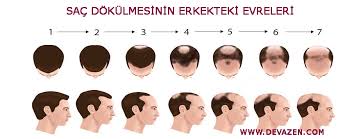 Dokulen Sac Geri Cikar Mi Sac Modelleri