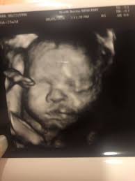 3 week old little pumpkin cuties