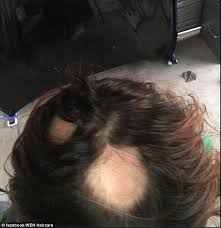 April 22nd 2021, 3:36 am. It Destroyed My Life Hundreds Of Women Sue Hair Care Label Endorsed By Brooke Shields And Alyssa Milano Over Claims The Product Made Their Hair Fall Out How To Sell Hair