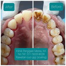 =) october 9, 2013 at 9:48 pm Rawa Klinik Pergigian Mesra Kota Kinabalu Bandar Sierra Facebook