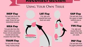 Pin On Breast Reconstruction Information