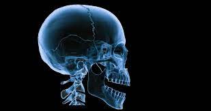 Image Result For Head X Ray Prints Body Joints Screen Printing