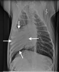 Runny nose and runny eyes are possible. Image Gallery Primary Metastatic Tumors Part 1 Clinician S Brief