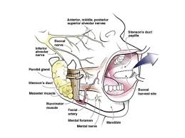 Carcinoma Buccal Mucosa Anatomy To Management