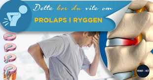 Det kan for eksempel være tunge. Alt Du Trenger A Vite Om Prolaps I Korsryggen Lumbal Skiveprolaps