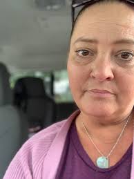 Starting cycle II of IV chemo treatment