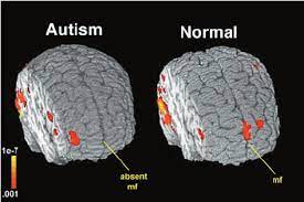 A new paper led by the university of virginia and just published in the journal behavioral and brain sciences is pushing back hard on. Significant Functional Activity During The Presentation Of Familiar Download Scientific Diagram