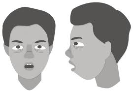 Much Ado about Sleep: Current Concepts