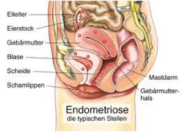 Bei den kontrollen durch den frauenarzt oder die hebamme wird zum ende der schwangerschaft hin der muttermund kontrolliert. Muttermund Anatomie Funktion Beschwerden Krank De