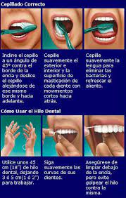 Como Limpiar Los Dientes Correctamente Como Limpiar