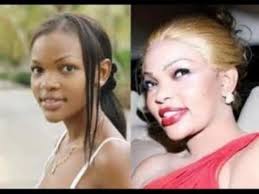 Black And White Bleaching Cream Results Pin On Actress