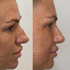 Aestheics nurse practitioner