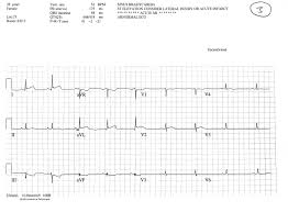 Image result for J Point