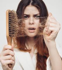 I also had hair loss when supplementing with iodine. All You Need To Know About Iodine For Hair Growth