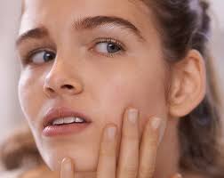 causes and treatments of acne boots ireland