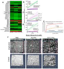 Differential Effects of Extracellular Vesicles from Two Different  Glioblastomas