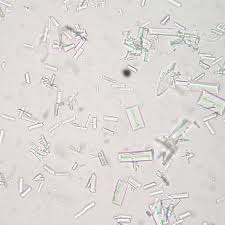 Struvite Magnesium Ammonium Phosphate Crystals Found Microscopically In A Urinalysis Of A Dog With A Bladde Urinary Tract Infection Urinary Tract Crystal Dog