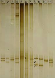 Image result for Putterlickia verrucosa