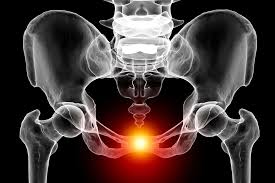 Image result for Pubic Apophysitis