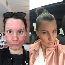 Reviews of CURE de Repos