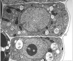 Generalized cell is used for structure of animal cell and plant cell to present the. Biology 130 Lab 3 Electron Micrographs