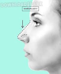 Nose job me's main feature is enjoy millions of the latest android apps, games, music, movies, tv, books, magazines & more. Rhinoplasty And Nose Job Android App Free Download In Apk