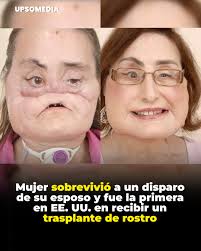 Darcie Hamilton, una escocesa de 22 años, convivió desde la infancia con  una sudoración excesiva que se volvió tan grave que debía ducharse entre 4  o 5 veces al día y llevar