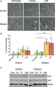Smooth muscle is composed of numerous spindled shaped cells. Dialysis Vascular Smooth Muscle Cells Vsmcs Show Increased Download Scientific Diagram