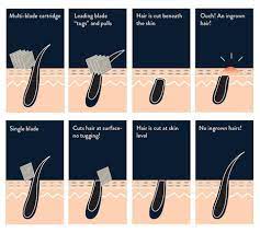 What Causes Razor Bumps And How Can You Stop Them – Rockwell Razors