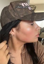 Her Beauty Aesthetic Center in Pasay Review