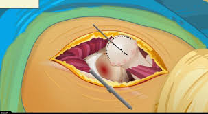 ameliyat oyunu oyna ameliyat oyunlari