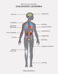 How do i treat my baby's worm infections are very common and spread easily. 11 Symptoms Of Leukemia In Children
