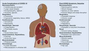 Postkovidový syndrom spousta lidí kteří prodělali koronavirovou infekci si stěžuje na to, že se již necítí tak jako předtím. A Clinic Blueprint For Post Coronavirus Disease 2019 Recovery Chest