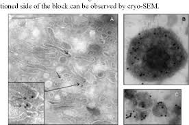 Maybe you would like to learn more about one of these? Figure 4 From Transmission Electron Microscopy In Cell Biology Sample Preparation Techniques And Image Information Semantic Scholar