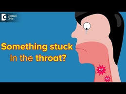 What To Do When There Is A Feeling Of Something Stuck In The Throat Dr Harihara Murthy Youtube In 2020 Feelings Lingual Tonsils Throat
