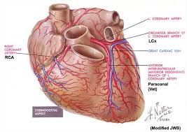 There are two main coronary arteries: 109 Single Coronary Type R2a Dr Buchanan S Cardiology Library Vin